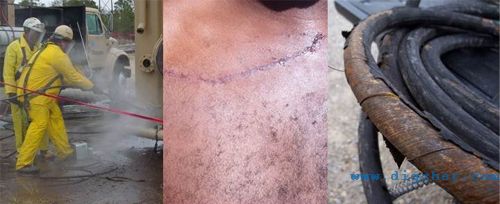 高壓水射流安全事故